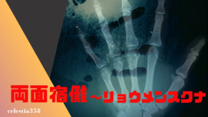 「リョウメンスクナ（両面宿儺）」とは？2chで伝説となった ...