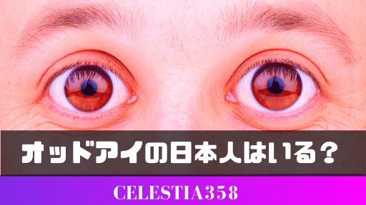 オッドアイの日本人や芸能人 有名人を画像付きで紹介 左右で目の色が違う人間について解説 セレスティア358